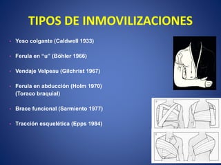 TIPOS DE INMOVILIZACIONES
• Yeso colgante (Caldwell 1933)
• Ferula en “u” (Böhler 1966)
• Vendaje Velpeau (Gilchrist 1967)
• Ferula en abducción (Holm 1970)
(Toraco braquial)
• Brace funcional (Sarmiento 1977)
• Tracción esquelética (Epps 1984)
 