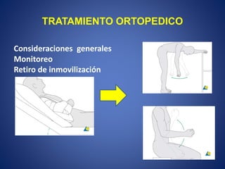 TRATAMIENTO ORTOPEDICO
Consideraciones generales
Monitoreo
Retiro de inmovilización
 