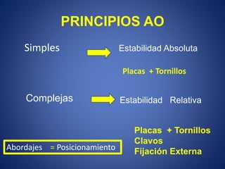 PRINCIPIOS AO
Simples Estabilidad Absoluta
Complejas Estabilidad Relativa
Placas + Tornillos
Placas + Tornillos
Clavos
Fijación ExternaAbordajes = Posicionamiento
 