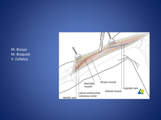 M. Biceps
M. Braquial
V .Cefalica
 