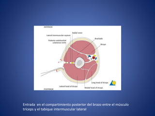 Entrada en el compartimiento posterior del brazo entre el músculo
tríceps y el tabique intermuscular lateral
 