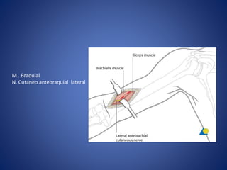 M . Braquial
N. Cutaneo antebraquial lateral
 