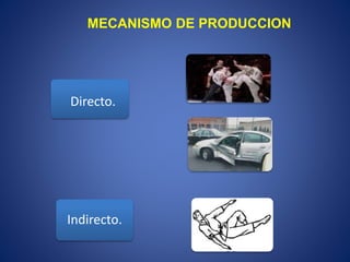 MECANISMO DE PRODUCCION
Directo.
Indirecto.
 