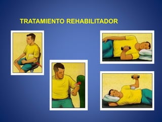 TRATAMIENTO REHABILITADOR
 