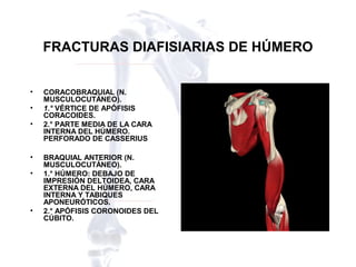 Fracturas diafisarias de humero (2) | PPT
