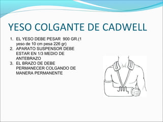 fracturas-diafisiarias-de-humero-ppt