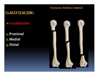 Localización:


1. Proximal
2. Medial
3. Distal
 