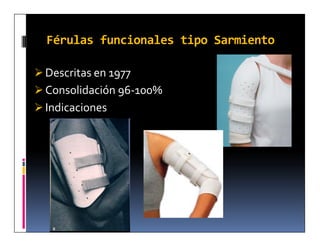 Férulas funcionales tipo Sarmiento

 Descritas en 1977
 Consolidación 96-100%
 Indicaciones
 