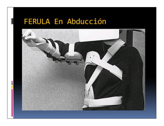 FERULA En Abducción
 
