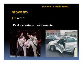  Directo:

 Es el mecanismo mas frecuente
 