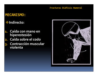  Indirecto:

1. Caída con mano en
   hiperestesión
2. Caída sobre el codo
3. Contracción muscular
   violenta
 