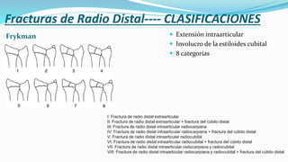 Fracturas de Radio Distal---- CLASIFICACIONES
Frykman  Extensión intraarticular
 Involucro de la estiloides cubital
 8 categorías
I: Fractura de radio distal extraarticular
II: Fractura de radio distal extraarticular + fractura del cúbito distal
III: Fractura de radio distal intraarticular radiocarpiana
IV: Fractura de radio distal intraarticular radiocarpiana + fractura del cúbito distal
V: Fractura de radio distal intraarticular radiocubital
VI: Fractura de radio distal intraarticular radiocubital + fractura del cúbito distal
VII: Fractura de radio distal intraarticular radiocarpiana y radiocubital
VIII: Fractura de radio distal intraarticular radiocarpiana y radiocubital + fractura del cúbito distal
 