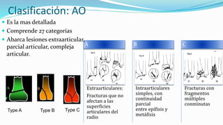Clasificación: AO
Extraarticulares:
Fracturas que no
afectan a las
superficies
articulares del
radio
A
Intraarticulares
simples, con
continuidad
parcial
entre epífisis y
metáfisis
B
Fracturas con
fragmentos
múltiples
conminutas
C
 Es la mas detallada
 Comprende 27 categorías
 Abarca lesiones extraarticular,
parcial articular, compleja
articular.
Type A Type CType B
 