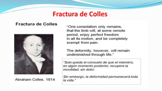 Fractura de Colles
 