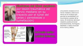 una presión excesiva en el
nervio mediano. Este es el
nervio en la muñeca que
permite la sensibilidad y el
movimiento a partes de la
mano. El síndrome del túnel
carpiano puede provocar
entumecimiento, hormigueo,
debilidad, o daño muscular
en la mano y dedos.
 