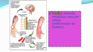 Fracturas distal del radio