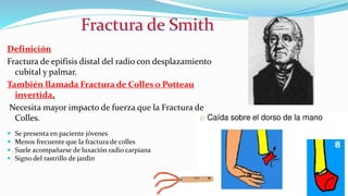 Definición
Fractura de epifisis distal del radio con desplazamiento
cubital y palmar.
También llamada Fractura de Colles o Potteau
invertida.
Necesita mayor impacto de fuerza que la Fractura de
Colles.
 Se presenta en paciente jóvenes
 Menos frecuente que la fractura de colles
 Suele acompañarse de luxación radio carpiana
 Signo del rastrillo de jardin
 