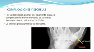 COMPLICACIONES Y SECUELAS
• Por la desviación palmar del fragmento distal, la
compresión del nervio mediano es aun mas
frecuente que en la fractura de Colles.
• La artrosis postraumática es frecuente.
 