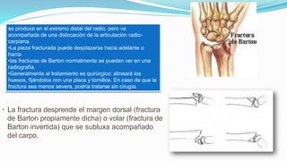 • La fractura desprende el margen dorsal (fractura
de Barton propiamente dicha) o volar (fractura de
Barton invertida) que se subluxa acompañado
del carpo.
se produce en el extremo distal del radio, pero va
acompañada de una dislocación de la articulación radio-
carpiana.
•La pieza fracturada puede desplazarse hacia adelante o
hacia.
•las fracturas de Barton normalmente se pueden ver en una
radiografía.
•Generalmente el tratamiento es quirúrgico: alineará los
huesos, fijándolos con una placa y tornillos. En caso de que la
fractura sea menos severa, podría tratarse sin cirugía.
 