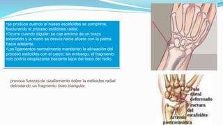 •se produce cuando el hueso escafoides se comprime,
fracturando el proceso estiloides radial.
•Ocurre cuando alguien se cae encima de un brazo
extendido y la mano se desvía hacia afuera con la palma
hacia adelante.
•Los ligamentos normalmente mantienen la alineación del
proceso estiloides con el carpo; sin embargo, el fragmento
roto podría desplazarse bastante lejos del resto del radio.
.
provoca fuerzas de cizallamiento sobre la estiloides radial
delimitando un fragmento óseo triangular.
 