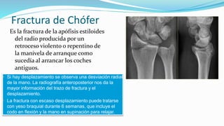 Fractura de Chófer
Es la fractura de la apófisis estiloides
del radio producida por un
retroceso violento o repentino de
la manivela de arranque como
sucedía al arrancar los coches
antiguos.
• Si hay desplazamiento se observa una desviación radial
de la mano. La radiografía anteroposterior nos da la
mayor información del trazo de fractura y el
desplazamiento.
• La fractura con escaso desplazamiento puede tratarse
con yeso braquial durante 6 semanas, que incluye el
codo en flexión y la mano en supinación para relajar.
 
