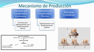 Mecanismo de Producción
Facturas por
Compresión-
Extensión
Fracturas por
aplastamiento con
desplazamiento
dorsal
Fracturas por
Compresión-
Flexión
Aplastamiento con
desplazamiento
palmar
Fracturas
Complejas
fuerza de compresión
obstáculo fijo esqueleto antebraquial
fractura de la EDR
Extensión
mayor menor
-lesiones escafoides - Fracturas antebrazo
-luxaciones semilunar
 