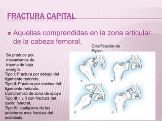 FRACTURA CAPITAL 
 Aquellas comprendidas en la zona articular 
de la cabeza femoral. 
Se produce por 
mecanismos de 
trauma de baja 
energía 
Tipo I: Fractura por debajo del 
ligamento redondo. 
Tipo II: Fractura por encima del 
ligamento redondo. 
Compromiso de zona de apoyo 
Tipo III: I y II con fractura del 
cuello femoral. 
Tipo IV: cualquiera de las 
anteriores mas fractura del 
acetábulo, 
Clasificación de 
Pipkin 
 