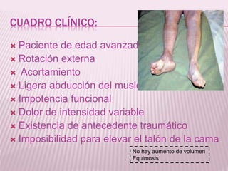 CUADRO CLÍNICO: 
 Paciente de edad avanzada 
 Rotación externa 
 Acortamiento 
 Ligera abducción del muslo 
 Impotencia funcional 
 Dolor de intensidad variable 
 Existencia de antecedente traumático 
 Imposibilidad para elevar el talón de la cama 
No hay aumento de volumen 
Equimosis 
 