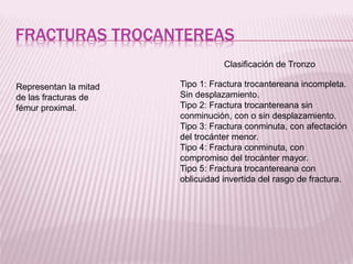 FRACTURAS TROCANTEREAS 
Representan la mitad 
de las fracturas de 
fémur proximal. 
Clasificación de Tronzo 
Tipo 1: Fractura trocantereana incompleta. 
Sin desplazamiento. 
Tipo 2: Fractura trocantereana sin 
conminución, con o sin desplazamiento. 
Tipo 3: Fractura conminuta, con afectación 
del trocánter menor. 
Tipo 4: Fractura conminuta, con 
compromiso del trocánter mayor. 
Tipo 5: Fractura trocantereana con 
oblicuidad invertida del rasgo de fractura. 
 
