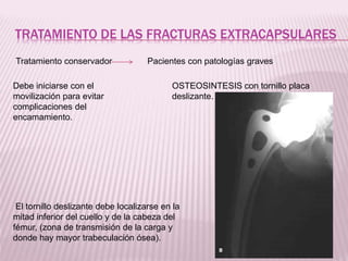 TRATAMIENTO DE LAS FRACTURAS EXTRACAPSULARES 
Tratamiento conservador Pacientes con patologías graves 
Debe iniciarse con el 
movilización para evitar 
complicaciones del 
encamamiento. 
OSTEOSINTESIS con tornillo placa 
deslizante. 
El tornillo deslizante debe localizarse en la 
mitad inferior del cuello y de la cabeza del 
fémur, (zona de transmisión de la carga y 
donde hay mayor trabeculación ósea). 
 