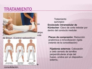 TRATAMIENTO 
Tratamiento 
ortopédico 
Tratamiento 
quirúrgico 
Reducción lenta y continua (tracción 
esquelética) 
Se elevan los pies del paciente 
poniendo un realce, para que el cuerpo 
actué de contrapeso. Se coloca férula 
de Braun. (Control radiográfico) 
En caso de tener una 
fractura distal o 
supracondílea (Férula de 
Putti) 
Puede completarse con yeso 
pelvipédico, 3-4 meses 
continuando con traccion hasta la 
consolidación. 
Enclavado intramedular de 
Küntscher: Clavo de corte trebolar por 
dentro del conducto medular. 
Placas de compresión: Reducción 
anatómica e inmovilización rígida 
(retardo de la consolidación) 
Fijadores externos: Colocación 
a cielo cerrado de tornillos 
perpendiculares al eje del 
hueso, unidos por un dispositivo 
externo, 
 