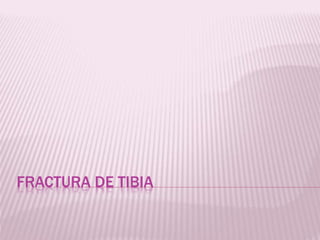 FRACTURA DE TIBIA 
 