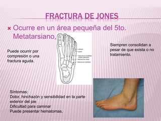 FRACTURA DE JONES 
 Ocurre en un área pequeña del 5to. 
Metatarsiano, 
Siempren consolidan a 
pesar de que exista o no 
tratamiento. 
Puede ocurrir por 
compresión o una 
fractura aguda. 
Síntomas: 
Dolor, hinchazón y sensibilidad en la parte 
exterior del pie 
Dificultad para caminar 
Puede presentar hematomas. 
 