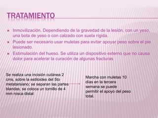 TRATAMIENTO 
 Inmovilización. Dependiendo de la gravedad de la lesión, con un yeso, 
una bota de yeso o con calzado con suela rígida. 
 Puede ser necesario usar muletas para evitar apoyar peso sobre el pie 
lesionado. 
 Estimulación del hueso. Se utiliza un dispositivo externo que no causa 
dolor para acelerar la curación de algunas fracturas 
Se realiza una incisión cutánea 2 
cms, sobre la estiloides del 5to 
metatarsiano; se separan las partes 
blandas, se coloca un tornillo de 4 
mm rosca distal 
Marcha con muletas 10 
días en la tercera 
semana se puede 
permitir el apoyo del peso 
total. 
 