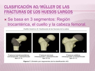 CLASIFICACIÓN AO/MÜLLER DE LAS 
FRACTURAS DE LOS HUESOS LARGOS 
 Se basa en 3 segmentos: Región 
trocantérica, el cuello y la cabeza femoral. 
 