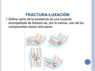 FRACTURA-LUXACIÓN
 Define como tal la existencia de una luxación
acompañada de fractura de, por lo menos, uno de los
componentes óseos articulares.
 
