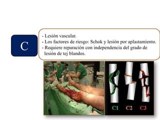 C
- Lesión vascular.
- Los factores de riesgo: Schok y lesión por aplastamiento.
- Requiere reparación con independencia del grado de
lesión de tej blandos.
 