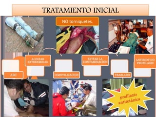 TRATAMIENTO INICIAL
NO torniquetes.
 