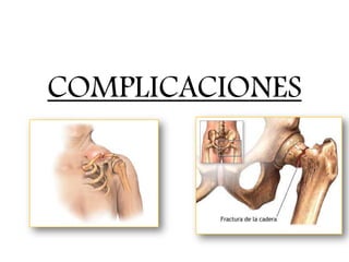 COMPLICACIONES
 