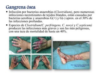 Gangrena ósea
 Infección por bacterias anaerobias (Clostridium), pero numerosas
infecciones necrotizantes de tejidos blandos, están causadas por
bacterias aerobias y anaerobias G(+) y G(-) aprox. en el 30% de
las infecciones profundas.
 Especies de Clostridium(C. perfringens, C. novyi y C.septicum)
producen las infecciones más graves y son las más peligrosas,
con una taza de mortalidad de hasta un 40%.
 