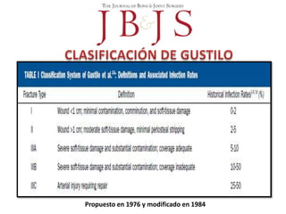 Propuesto en 1976 y modificado en 1984
 
