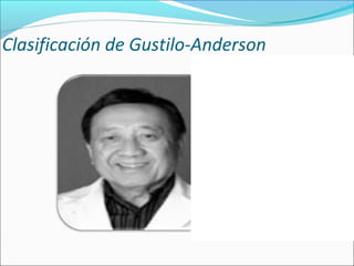 Clasificación de Gustilo-Anderson

 