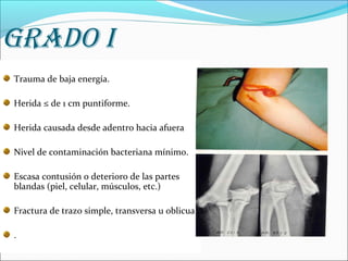 GRADO I
Trauma de baja energía.
Herida ≤ de 1 cm puntiforme.
Herida causada desde adentro hacia afuera
Nivel de contaminación bacteriana mínimo.
Escasa contusión o deterioro de las partes
blandas (piel, celular, músculos, etc.)
Fractura de trazo simple, transversa u oblicua
.

 