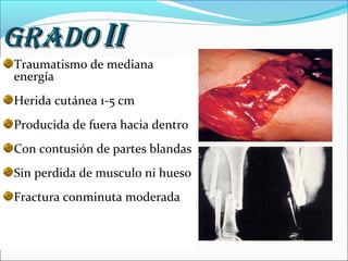GRADO II
Traumatismo de mediana
energía
Herida cutánea 1-5 cm
Producida de fuera hacia dentro
Con contusión de partes blandas
Sin perdida de musculo ni hueso
Fractura conminuta moderada

 