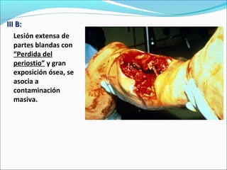 III B:
Lesión extensa de
partes blandas con
“Perdida del
periostio” y gran
exposición ósea, se
asocia a
contaminación
masiva.

 