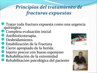 Principios del tratamiento de
fracturas expuestas

Tratar toda fractura expuesta como una urgencia
quirúrgica.
Completa evaluación inicial
Antibioticoterapia.
Desbridamiento.
Estabilización de la Fractura
Cierre apropiado de la herida
Injerto precoz con hueso esponjoso
Rehabilitación de la extremidad
Rehabilitación psicológica del paciente

 