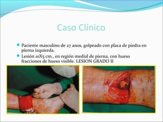 Caso Clínico
 Paciente masculino de 27 anos, golpeado con placa de piedra en

pierna izquierda.
 Lesión 10X5 cm., en región medial de pierna, con hueso
fracciones de hueso visible. LESION GRADO II

 