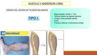 GUSTILO Y ANDERSON (1984)
GRADO DE LESION EN TEJIDOS BLANDOS
TIPO I
- Baja energía, herida < 1cm.
- Mínima lesión de tejidos blandos
- Limpia, más probable dentro
- fuera.
- Fractura oblicua o transversa simple
 