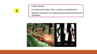  Lesión vascular.
 Los factores de riesgo: Schok y lesión por aplastamiento.
 Requiere reparación con independencia del grado de lesión de
tej blandos.
C
 