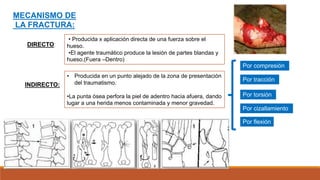 • Producida x aplicación directa de una fuerza sobre el
hueso.
•El agente traumático produce la lesión de partes blandas y
hueso.(Fuera –Dentro)
MECANISMO DE
LA FRACTURA:
DIRECTO:
INDIRECTO:
• Producida en un punto alejado de la zona de presentación
del traumatismo.
•La punta ósea perfora la piel de adentro hacia afuera, dando
lugar a una herida menos contaminada y menor gravedad.
Por compresión
Por tracción
Por torsión
Por cizallamiento
Por flexión
 